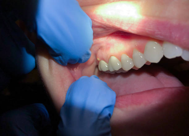 Professional Emergency Dental Service in OH