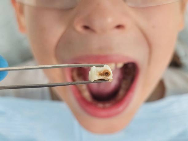 Best Emergency Denture Repair in North Baltimore, OH
